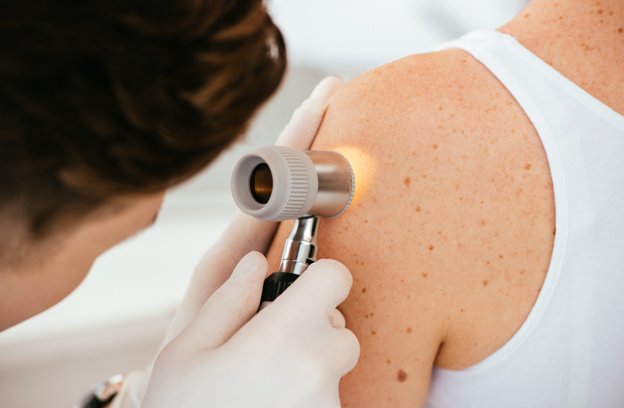 Skin Checks