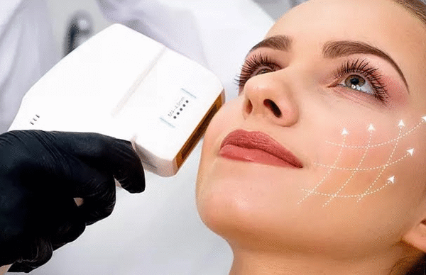 hifu facial treatment