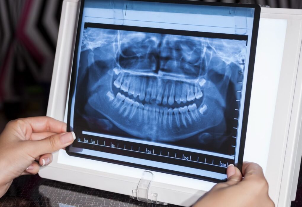 Panoramic X-Ray