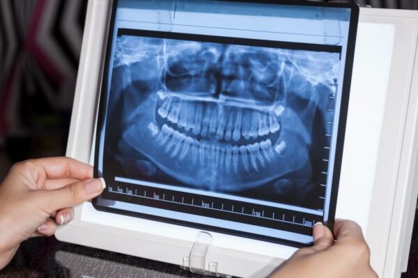 Panoramic X-Ray